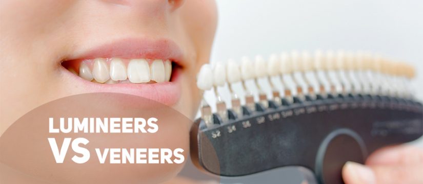 lumineers vs veneers